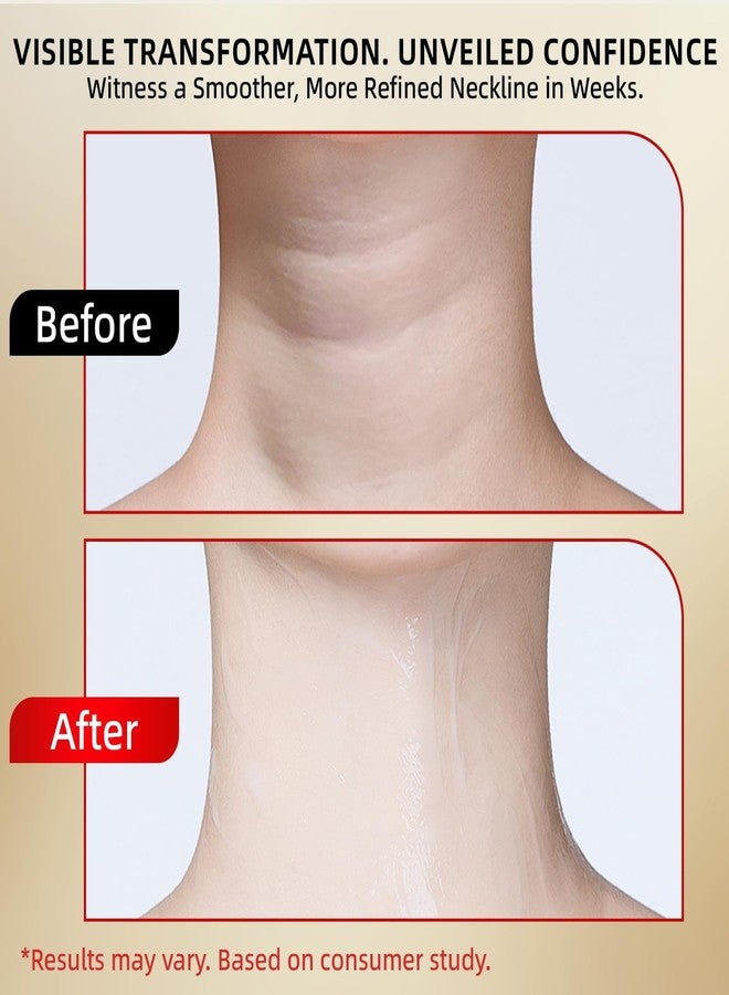 Redcool Retinol Neck Firming Cream – Neck Cream for Firming and Tightening, Skin Tightening Cream for Face, Tighten and Lift Neck Cream with Collagen & Hyaluronic Acid, 1.76 oz-zz-1202-1 - Image 5